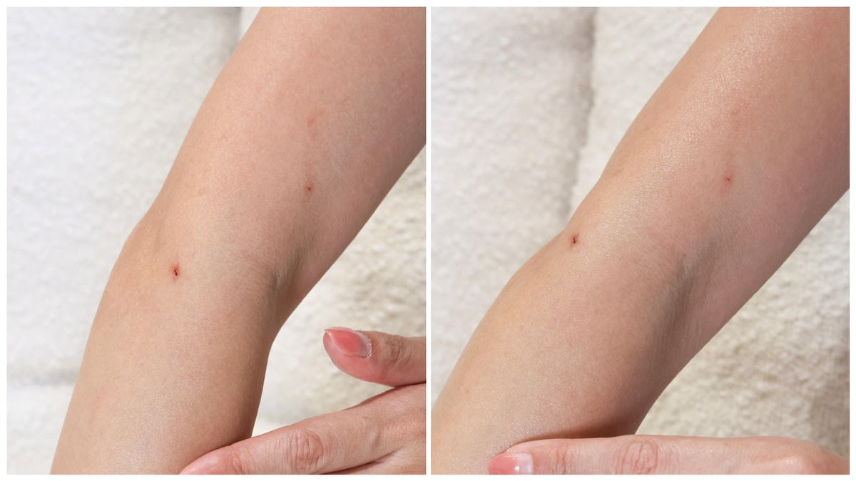 【皮膚科醫師推薦】維持肌膚/皮膚健康 Dermoflan A 【皮膚科醫師推薦】維持肌膚/皮膚健康 Dermoflan A