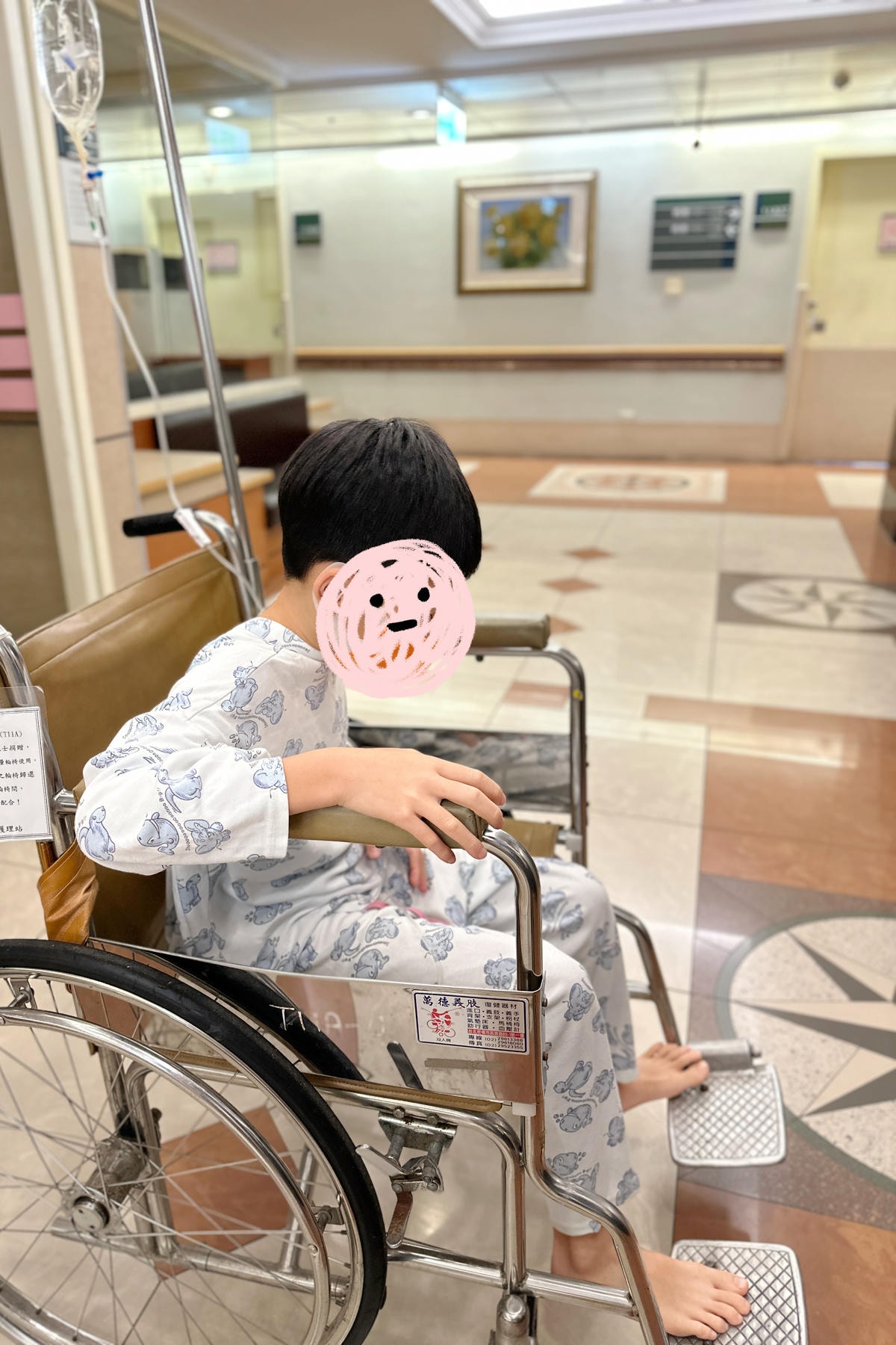 【育兒紀錄】孩子竟然有多生齒！多生牙開刀 紀錄